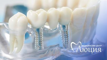 ��������� �������������� ����� �� ������������ | ������� �����