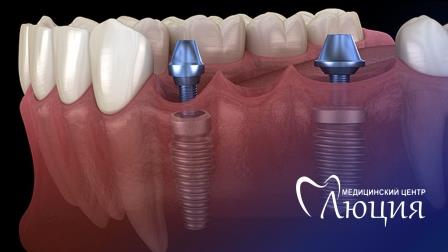 ��������� ������ �������� - ������������ �����, �����������