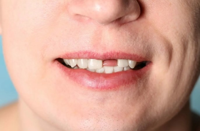 Имплантация зубов - Стоматология 21 Век, Краснодар
