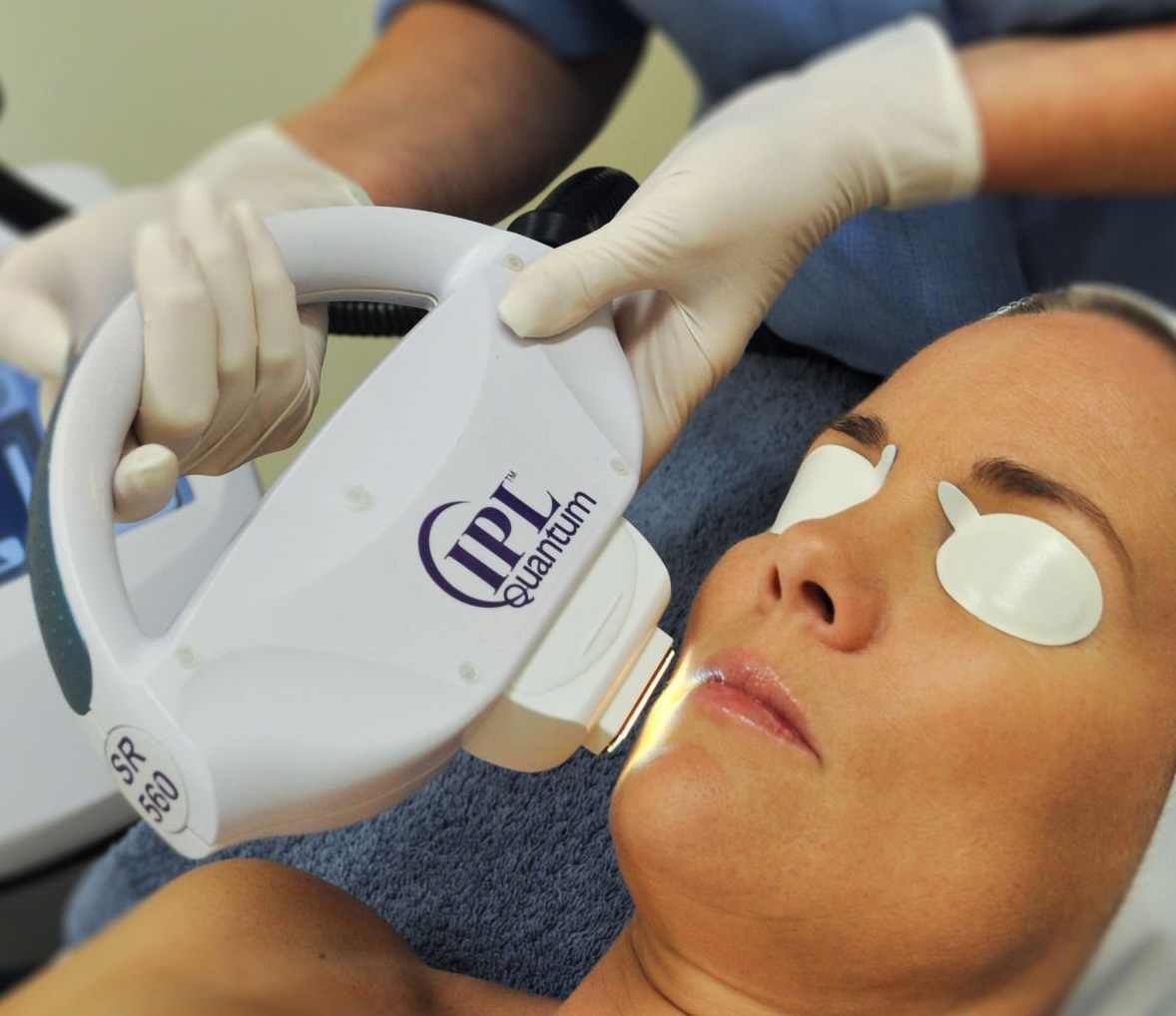 Ipl photorejuvenation does it work Ipl photorejuvenation does it work
