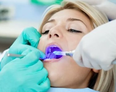 Лечение кариеса зубов - стоматология Клиника Прокофьевых, Краснодар