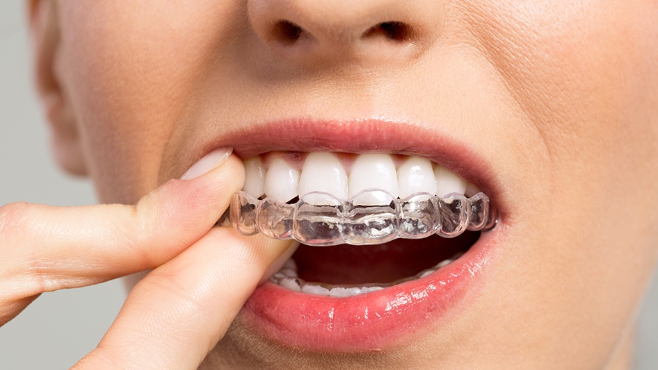 Ортодонтия - стоматология 21 Век, Краснодар