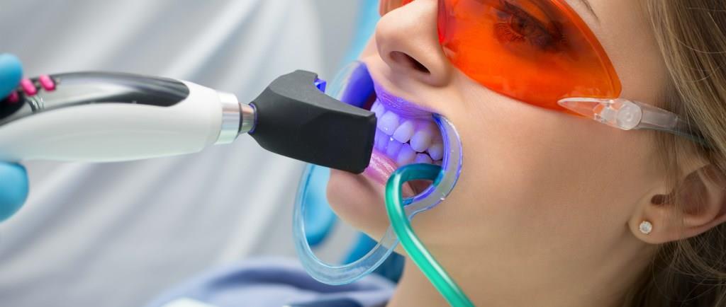 Отбеливание зубов - Стоматология 21 Век, Краснодар