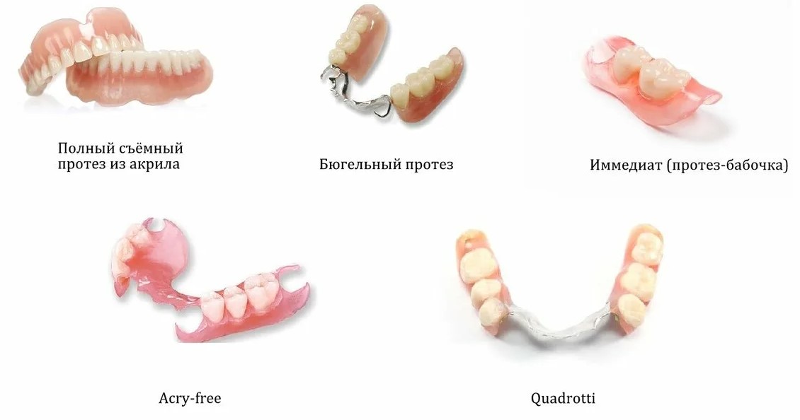 Протезирование зубов во Владикавказе - стоматология Люция